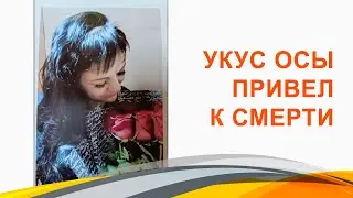 Укус осы привел к смерти.