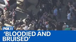 Protesters clash outside LA synagogue