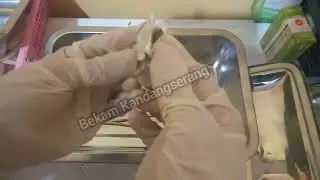 Cara memasang Bisturi untuk Bekam