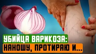 Нанесла и протёрла: как я луком убрала узлы и звёздочки, а ещё можно принимать смешивая с...