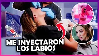 ME INYECTÉ LOS LABIOS - ME CAMBIÉ EL LOOK - Samii Herrera