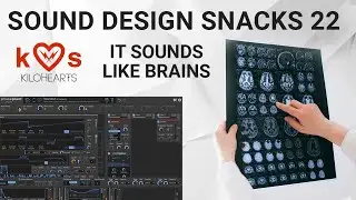 What is a Neuro Bass? – Sound Design Snacks 22