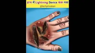 हाथ में Lightning Device फंस गया 😲 