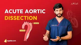 Acute Aortic Dissection | Classification, Clinical Features, Differential Diagnosis |Surgery Lecture