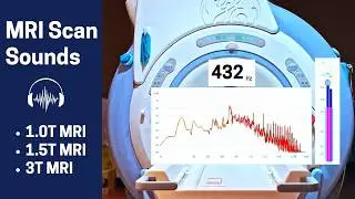 3T MRI Sounds With Audio Frequency Analyzer (1.5T MRI, 1.0T MRI sounds included)