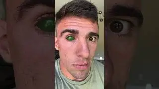 MY GREENSCREEN EYEBALL 😮