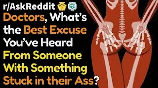 Doctors, what are the funniest reasons why people stick stuff up their ass? (r/AskReddit | Reddit)