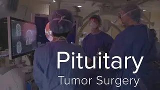 Minimally Invasive Approach to Treating Pituitary Tumors - Yale Medicine Explains