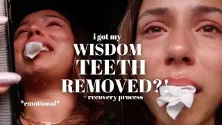 WISDOM TEETH SURGERY VLOG: getting all four removed!! *emotional*