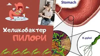 Хеликобактер Пилори 🦠 Как избавиться без антибиотиков?