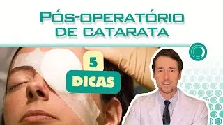 Pós-operatório de catarata: 5 dicas essenciais.