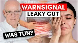 Anzeichen Leaky Gut: Was dahinter steckt und was sie tun können (wichtig!)