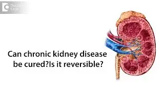 Can chronic kidney disease be cured? Is it reversible?-Dr Girish NS