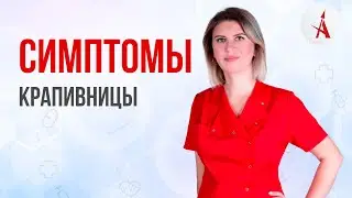 СИМПТОМЫ КРАПИВНИЦЫ