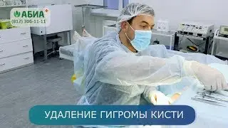 Удаление гигромы кисти в клинике 