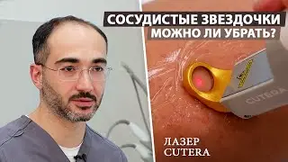 Как лечить сосудистую сетку на ногах?