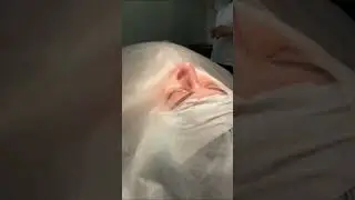 Превосходный и талантливый пластический хирург Магомед Исламович выполняет идеально свою работу 🔥👌