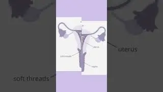 Copper T IUD side effects #coppert #iud #cramping #contraceptivemethod #heavybleeding #vomiting