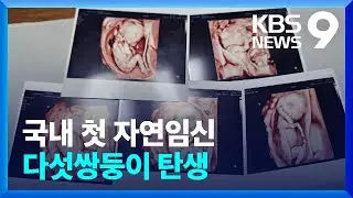 국내 첫 자연임신 다섯쌍둥이 탄생 [9시 뉴스] / KBS  2024.09.21.