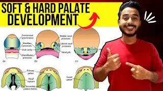 development of palate embryology | soft palate development embryology