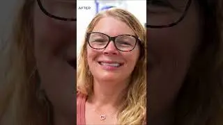 3...2...1... New Smile Time! 😍 
