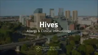 Hives