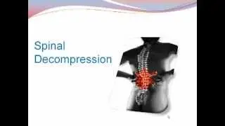 Herniated Disc Chiropractor Manalapan NJ | (732) 780-8832