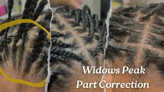 Widows Peak Parting