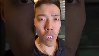Becoming the WORLD DART CHAMPION