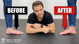 How To Fix Flat Feet With Exercises At Home