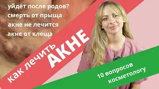 Лечение акне: ретиноиды, клещ Demodex, гормоны. 10 вопросов косметологу #акне #акнелечение #прыщи