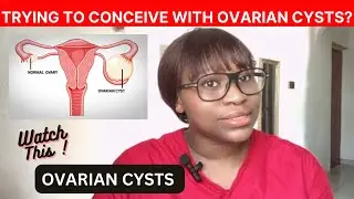 OVARIAN CYSTS || CAUSES, SYMPTOMS AND TREATMENT OF OVARIAN CYSTS