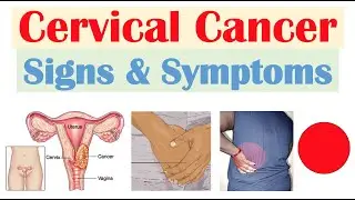 Cervical Cancer Signs & Symptoms (& Why They Occur)