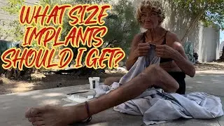 Angela wants new teeth and implants 8/29/24 update
