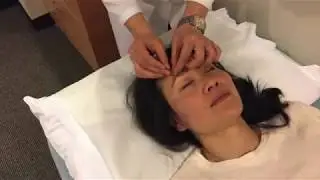 Cosmetic Facial Acupuncture at TCM Healing Center, Los Angeles CA