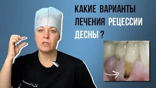 Какие варианты лечения рецессии десны🤔