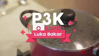 Tahun Baru? Waspadai Luka Bakar pada Anak