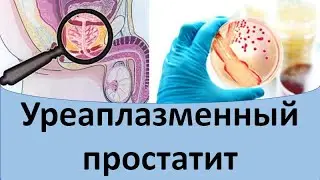 Уреаплазменный простатит