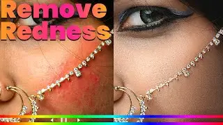 How to Remove Skin Redness - Photoshop Tutorial