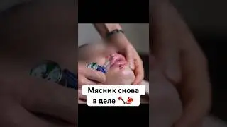 Мясник косметолог вернулся! Брауде и Коносова #омоложение #косметология #морщины #ботокс #пилинг
