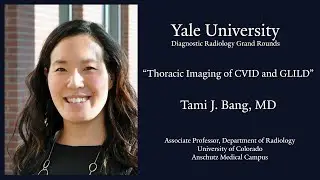 Thoracic Imaging of CVID and GLILD