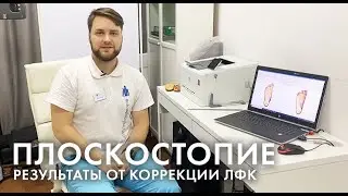 Коррекция плоскостопия. Результат работы со стопами за 12 занятий