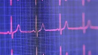 Can Sudden Cardiac Arrest Be Prevented?