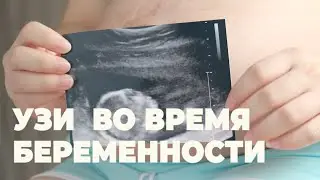 Узи при Беременности Сроки .  Вред УЗИ при Беременности.