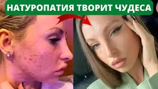 Здоровье, спорт и красота. Отзыв о консультации врача-натуропата Артёма Якумова (Влада Лещинская).