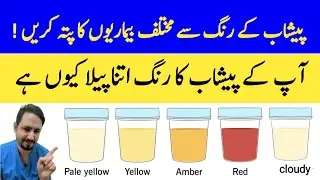 What The Color of Your Urine Says About Your Health In Urdu Hindi- Irfan Azeem