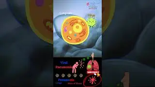 Pneumonia 🔬 Viral Lungs infection 🦟 respiratory virus 🕳  2024