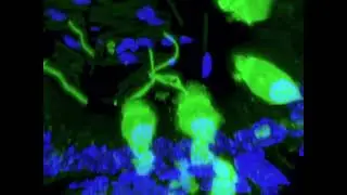 Epithelial Cells Send “Nanotubes” in the Epididymis | Massachusetts General Hospital