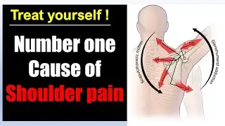 Fix shoulder popping click with New rotator cuff stretch: Shoulder pain relief massage and exercises