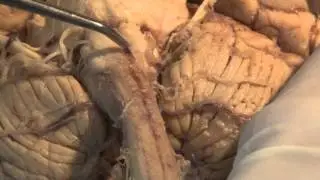 The Most Important Pathway: Motor Control: Neuroanatomy Video Lab - Brain Dissections